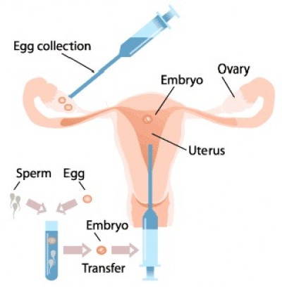 ivf_en